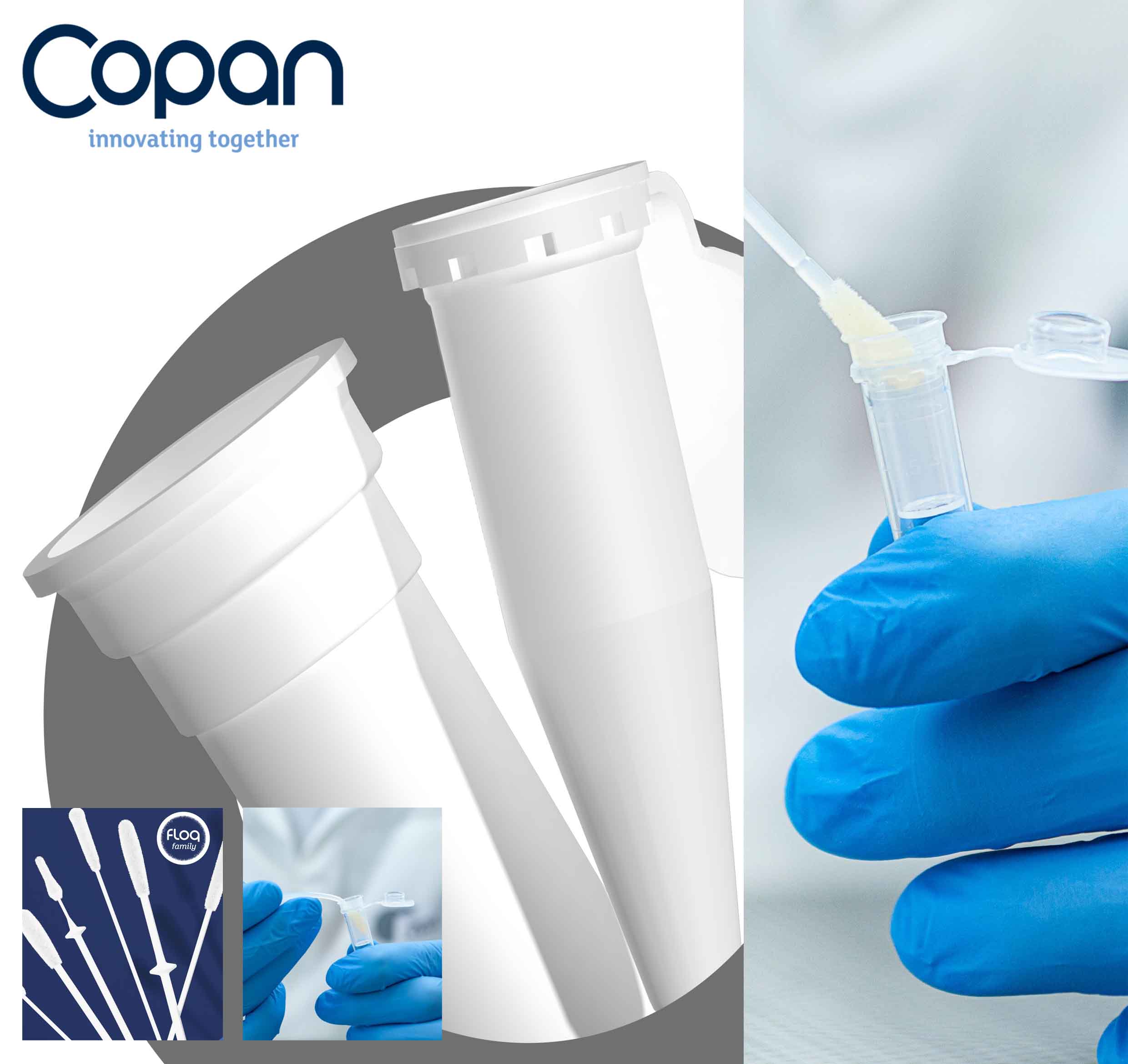 NAO Basket For rapid and efficient DNA recovery